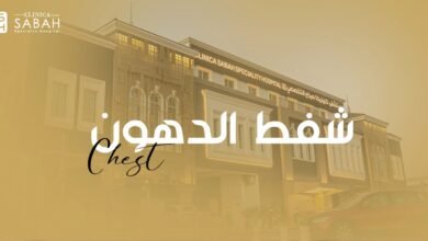 عملية شفط الدهون