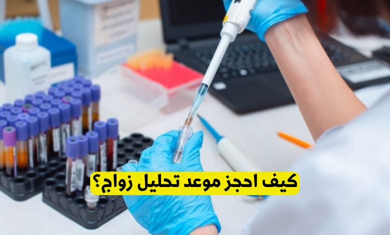 حجز موعد تحليل زواج