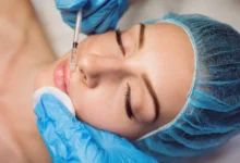 افضل دكتور تجميل في مصر